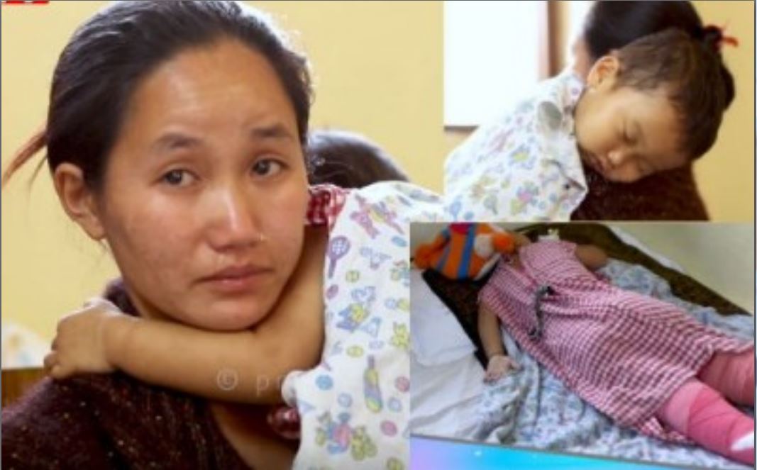 तातो दुधमा डुबेर २ बर्षे बालकको यस्तो दर्दनाक अवस्था; सहयोगको भिख माग्दै भक्कानिदै रोइन आमा