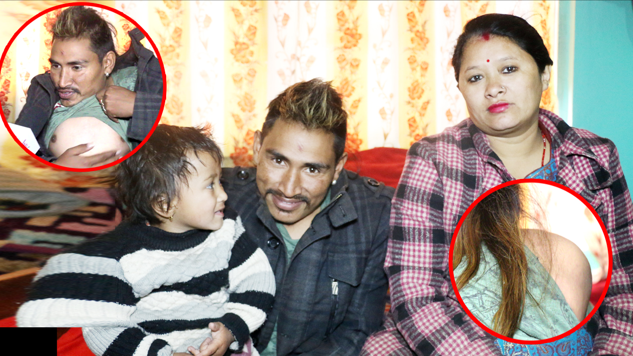 यी उदाहरणीय अशक्त जोडी जसले सबैलाई हसाउने गर्छन तर परिवारको यस्तो हालत,डाक्टर भन्छन ‘उपचार हुदैन”