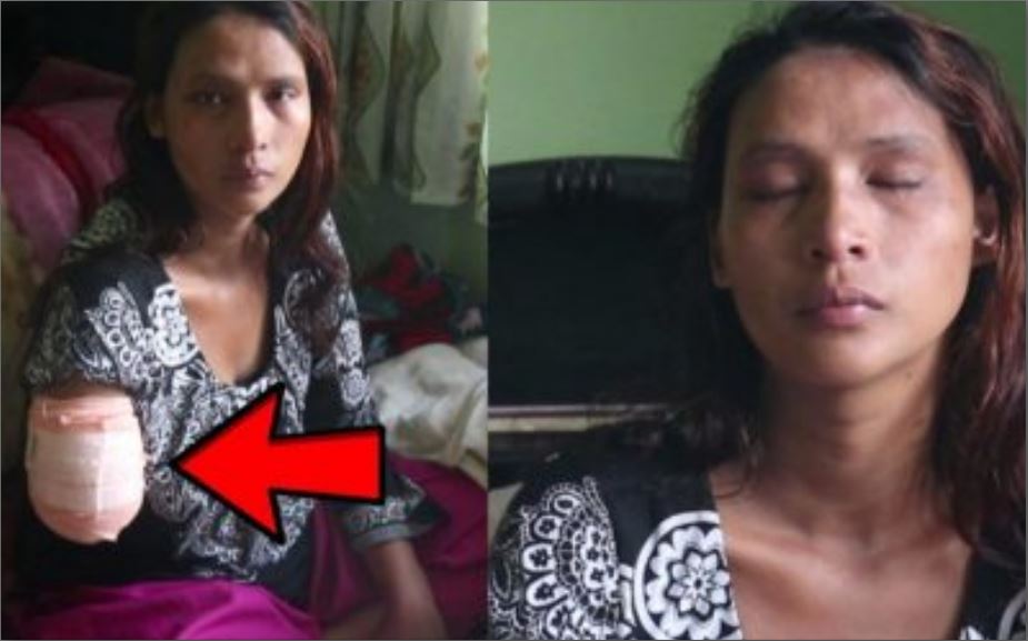 लोग्ने पिडित बिमला बिक रुदै यस्तो अवस्थामा अईन मिडियामा, कसले बनायो यस्तो हालत (भिडियो)