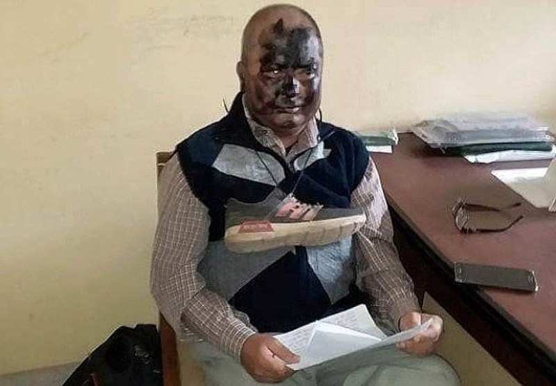 प्राध्यापकलाई कालो मोसो र जुत्ताको माला