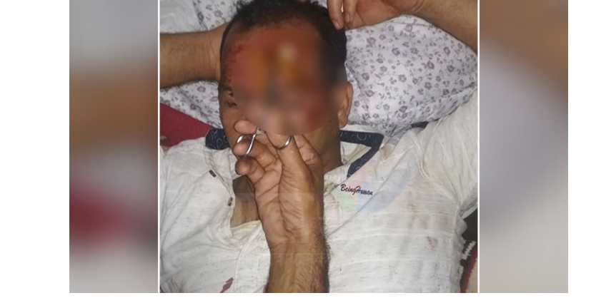 आफ्नै पार्टीका नेताबाट वडा अध्यक्ष नरेन्द्र बस्नेत माथि कु*टपि*ट