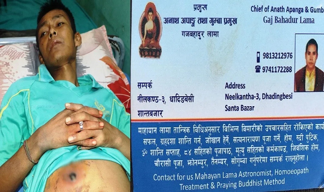 उपचार गर्ने भन्दै लामा झाँक्रीले पेटमा प्वाल पारिदिए पछि….
